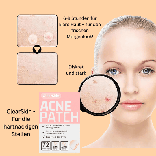 ClearSkin Acne Patches