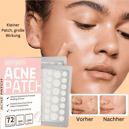 ClearSkin Acne Patches